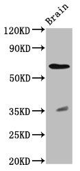 RPE65 Antibody - Positive Western Blot detected in Rat brain tissue. All lanes: RPE65 antibody at 2.3 µg/ml Secondary Goat polyclonal to rabbit IgG at 1/50000 dilution. Predicted band size: 61 KDa. Observed band size: 61 KDa