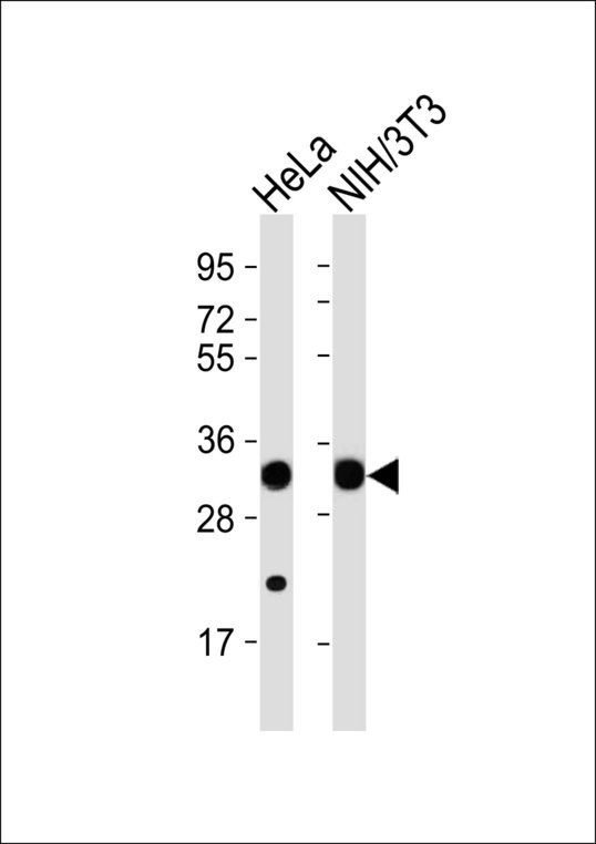 RPS2 / Ribosomal Protein S2 Antibody - All lanes : Anti-RPS2 Antibody at 1:1000 dilution Lane 1: HeLa whole cell lysates Lane 2: NIH/3T3 whole cell lysates Lysates/proteins at 20 ug per lane. Secondary Goat Anti-Rabbit IgG, (H+L),Peroxidase conjugated at 1/10000 dilution Predicted band size : 31 kDa Blocking/Dilution buffer: 5% NFDM/TBST.
