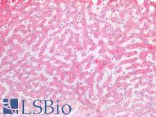 RPS2 / Ribosomal Protein S2 Antibody - Human Liver: Formalin-Fixed, Paraffin-Embedded (FFPE)