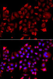 RRM2B / P53R2 Antibody - Immunofluorescence analysis of A549 cells.