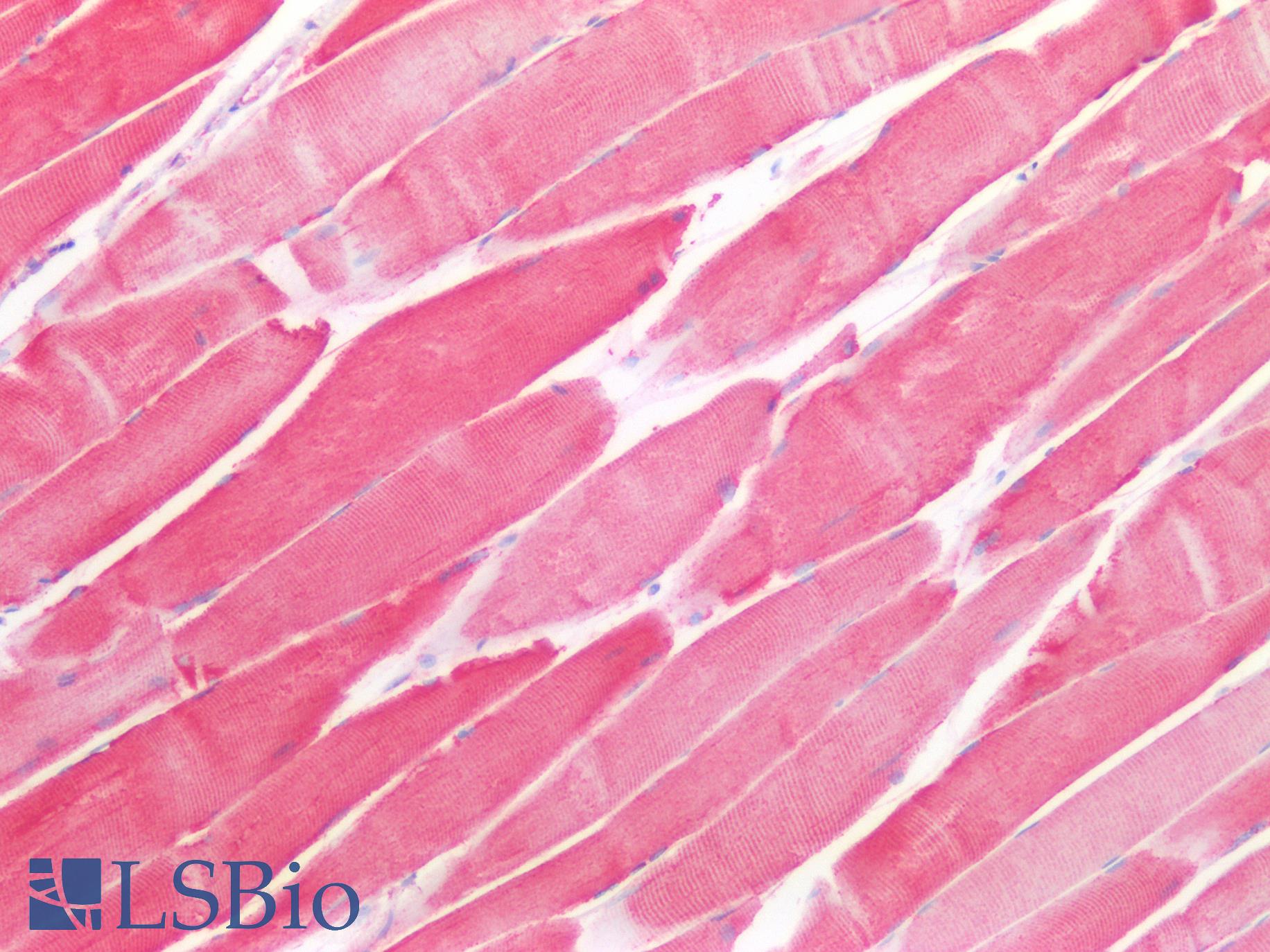 RRM2B / P53R2 Antibody - Human Skeletal Muscle: Formalin-Fixed, Paraffin-Embedded (FFPE)