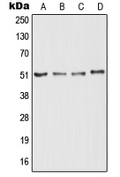 RTN4R Antibody - Western blot analysis of RTN4R expression in K562 (A); MCF7 (B); mouse brain (C); rat brain (D) whole cell lysates.