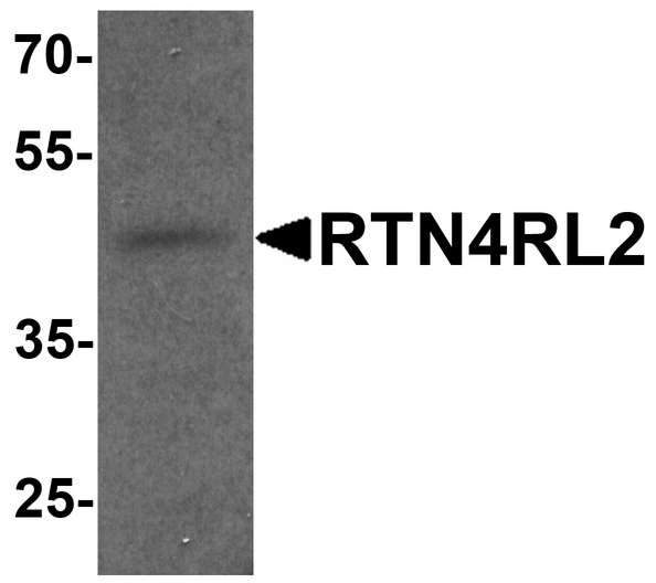 RTN4RL2 Antibody - Western blot analysis of RTN4RL2 in rat brain tissue lysate with RTN4RL2 antibody at 1 ug/ml.