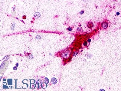 RXFP1/ LGR7 Antibody - Brain, Temporal Cortex, neurons and glia