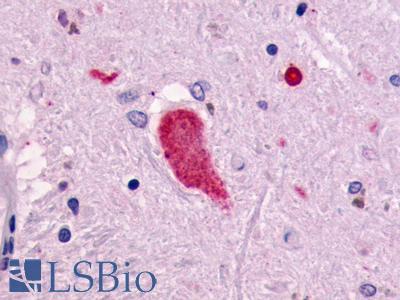 RXFP1/ LGR7 Antibody - Brain, Parkinson's Disease, neuron