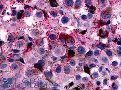 RXFP1/ LGR7 Antibody - Skin, melanoma