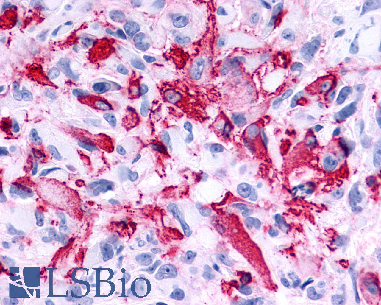 RXFP2 / LGR8 Antibody - Brain, Glioblastoma