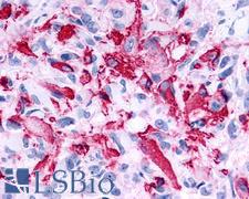 RXFP2 / LGR8 Antibody - Brain, Glioblastoma