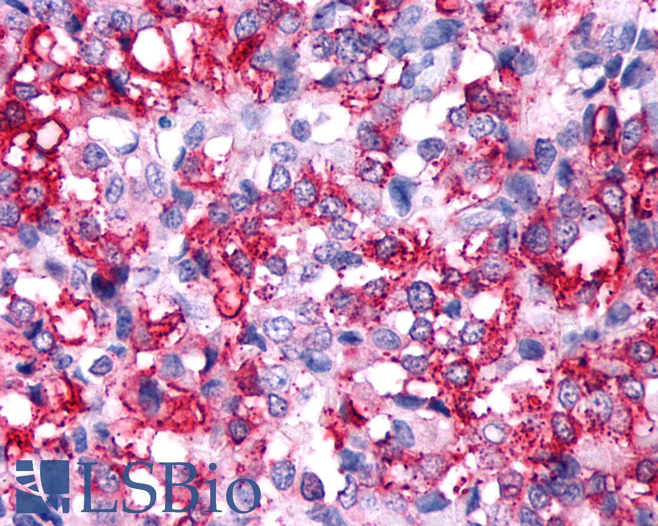 RXFP2 / LGR8 Antibody - Breast, carcinoma
