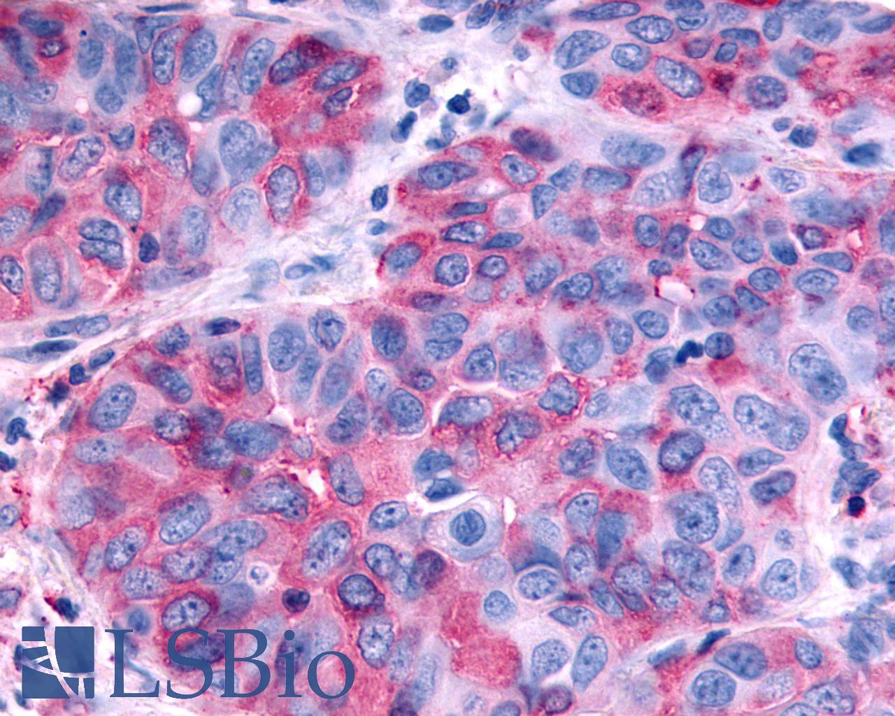 RXFP2 / LGR8 Antibody - Lung, non small-cell carcinoma