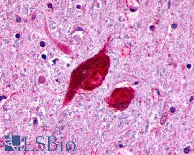 RXFP3 Antibody - Brain, substantia nigra
