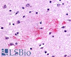 RXFP3 Antibody - Brain, Alzheimer's disease senile plaque