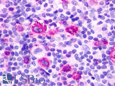 RXFP4 / GPR100 Antibody - Hodgkin's lymphoma