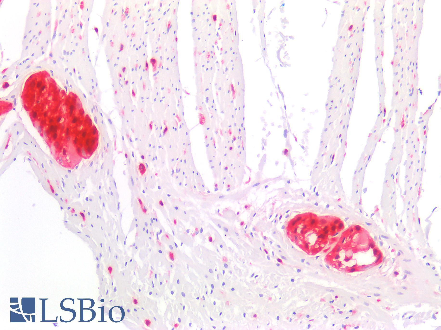 S100 Protein Antibody - Human Small Intestine: Formalin-Fixed, Paraffin-Embedded (FFPE)