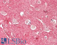 S100A1 / S100-A1 Antibody - Human Brain, Cortex: Formalin-Fixed, Paraffin-Embedded (FFPE)