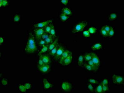 S100A1 / S100-A1 Antibody - Immunofluorescence staining of HepG2 cells with S100A1 Antibody at 1:133, counter-stained with DAPI. The cells were fixed in 4% formaldehyde, permeabilized using 0.2% Triton X-100 and blocked in 10% normal Goat Serum. The cells were then incubated with the antibody overnight at 4°C. The secondary antibody was Alexa Fluor 488-congugated AffiniPure Goat Anti-Rabbit IgG(H+L).