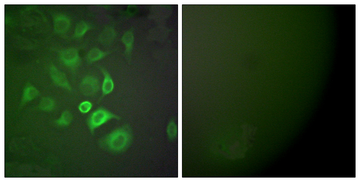 S100A1 / S100-A1 Antibody - Immunofluorescence analysis of A549 cells, using S100 A1 Antibody. The picture on the right is blocked with the synthesized peptide.