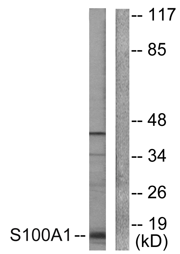 S100A1 / S100-A1 Antibody - Western blot analysis of lysates from A549 cells, using S100 A1 Antibody. The lane on the right is blocked with the synthesized peptide.