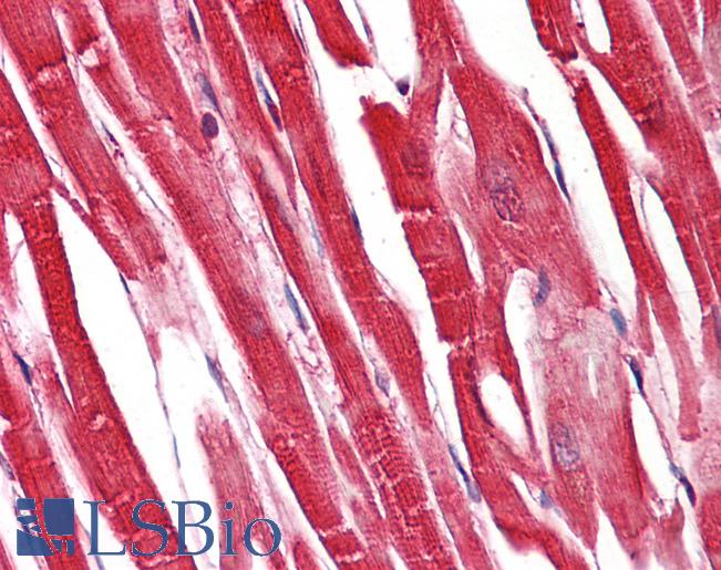 S100A1 / S100-A1 Antibody - Anti-S100A1 / S100 antibody IHC of human heart. Immunohistochemistry of formalin-fixed, paraffin-embedded tissue after heat-induced antigen retrieval. Antibody dilution 1:100.