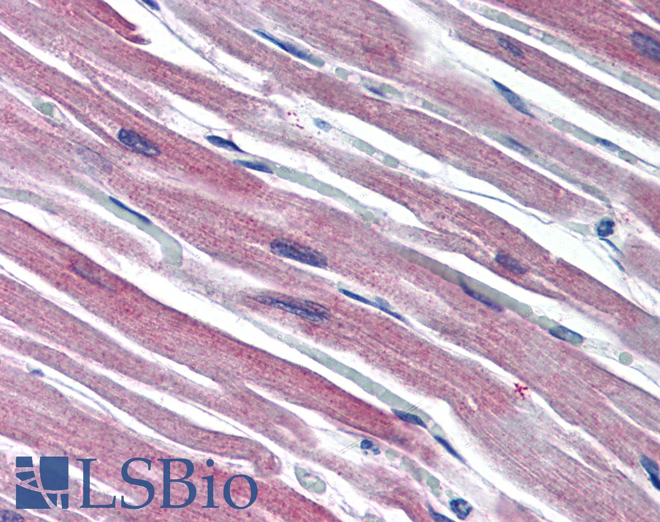 S100A1 / S100-A1 Antibody - Anti-S100A1 / S100 antibody IHC of human heart. Immunohistochemistry of formalin-fixed, paraffin-embedded tissue after heat-induced antigen retrieval. Antibody concentration 10 ug/ml.