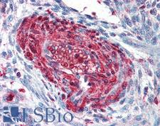 S100A4 / FSP1 Antibody - Anti-S100A4 antibody IHC of human uterus, vessel. Immunohistochemistry of formalin-fixed, paraffin-embedded tissue after heat-induced antigen retrieval. Antibody concentration 5 ug/ml.
