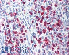 S100A4 / FSP1 Antibody - Human Spleen: Formalin-Fixed, Paraffin-Embedded (FFPE)