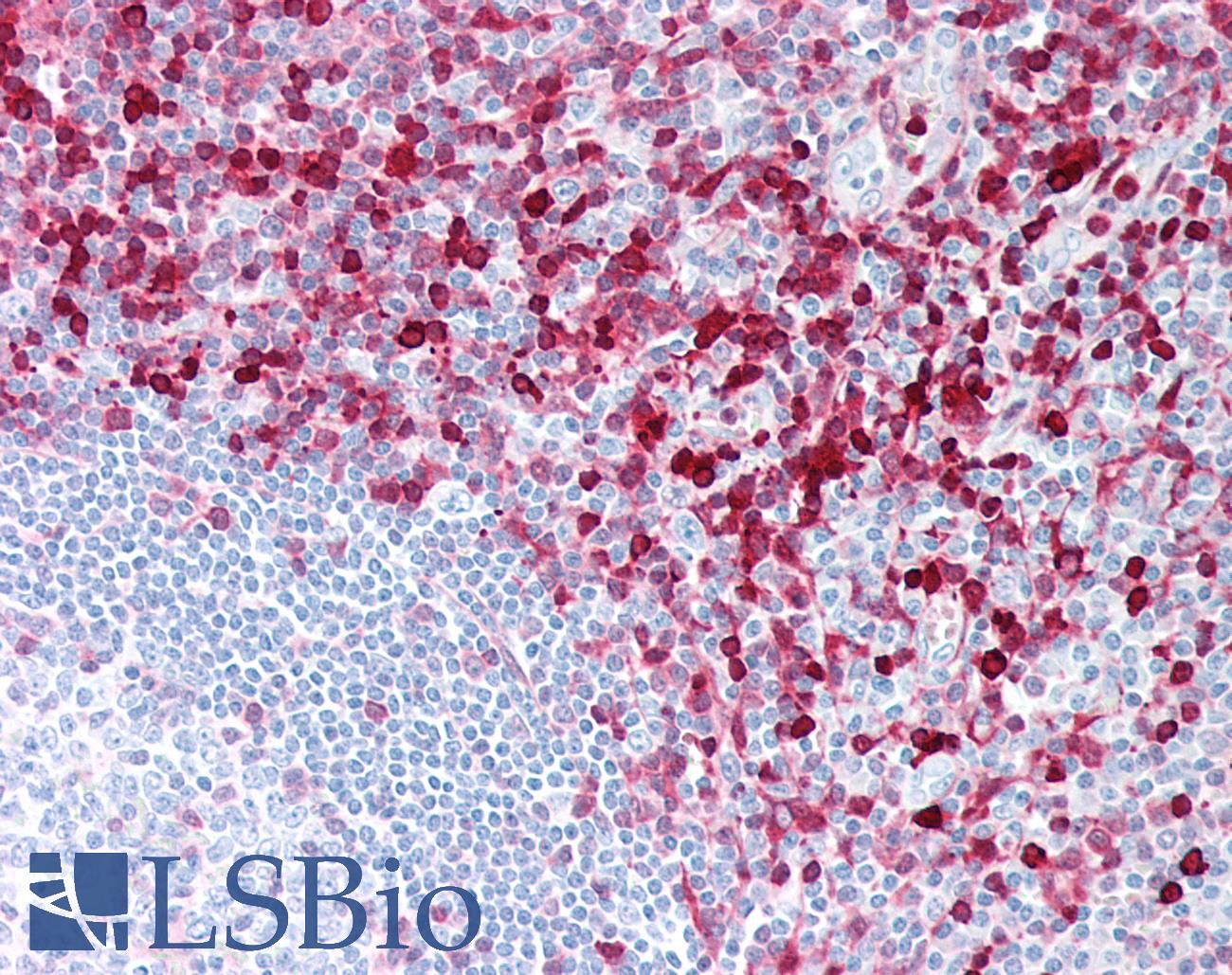 S100A4 / FSP1 Antibody - Human Tonsil: Formalin-Fixed, Paraffin-Embedded (FFPE)
