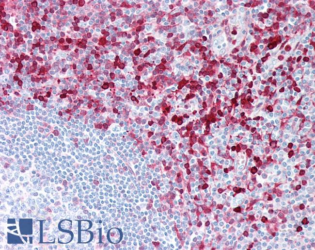 S100A4 / FSP1 Antibody - Human Tonsil: Formalin-Fixed, Paraffin-Embedded (FFPE)