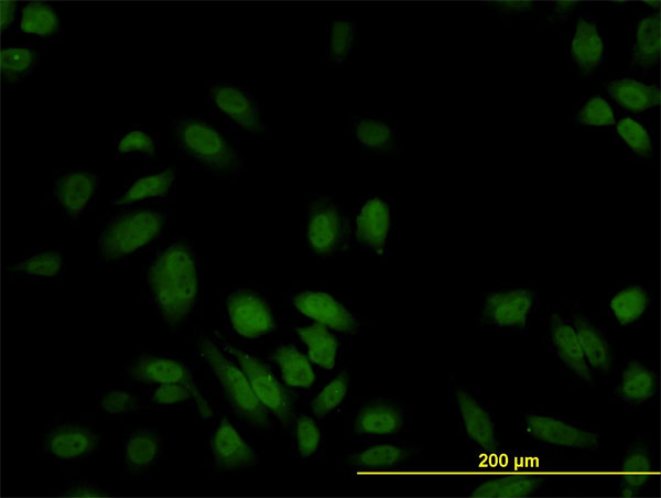 S100A6 / Calcyclin Antibody - Immunofluorescence of monoclonal antibody to S100A6 on HeLa cell. [antibody concentration 10 ug/ml]
