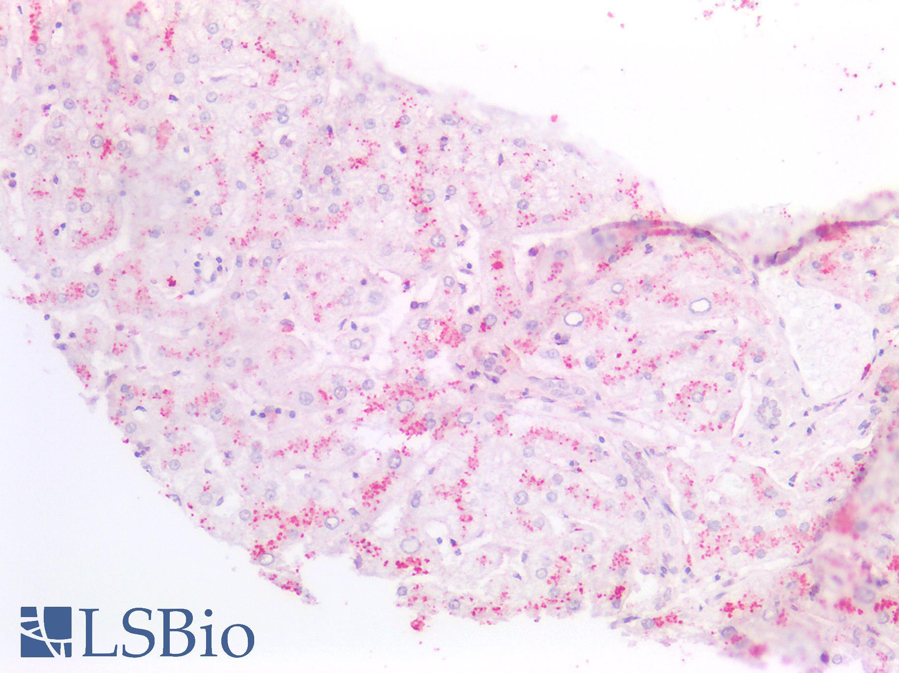 S100A8 / MRP8 Antibody - Human Liver: Formalin-Fixed, Paraffin-Embedded (FFPE)