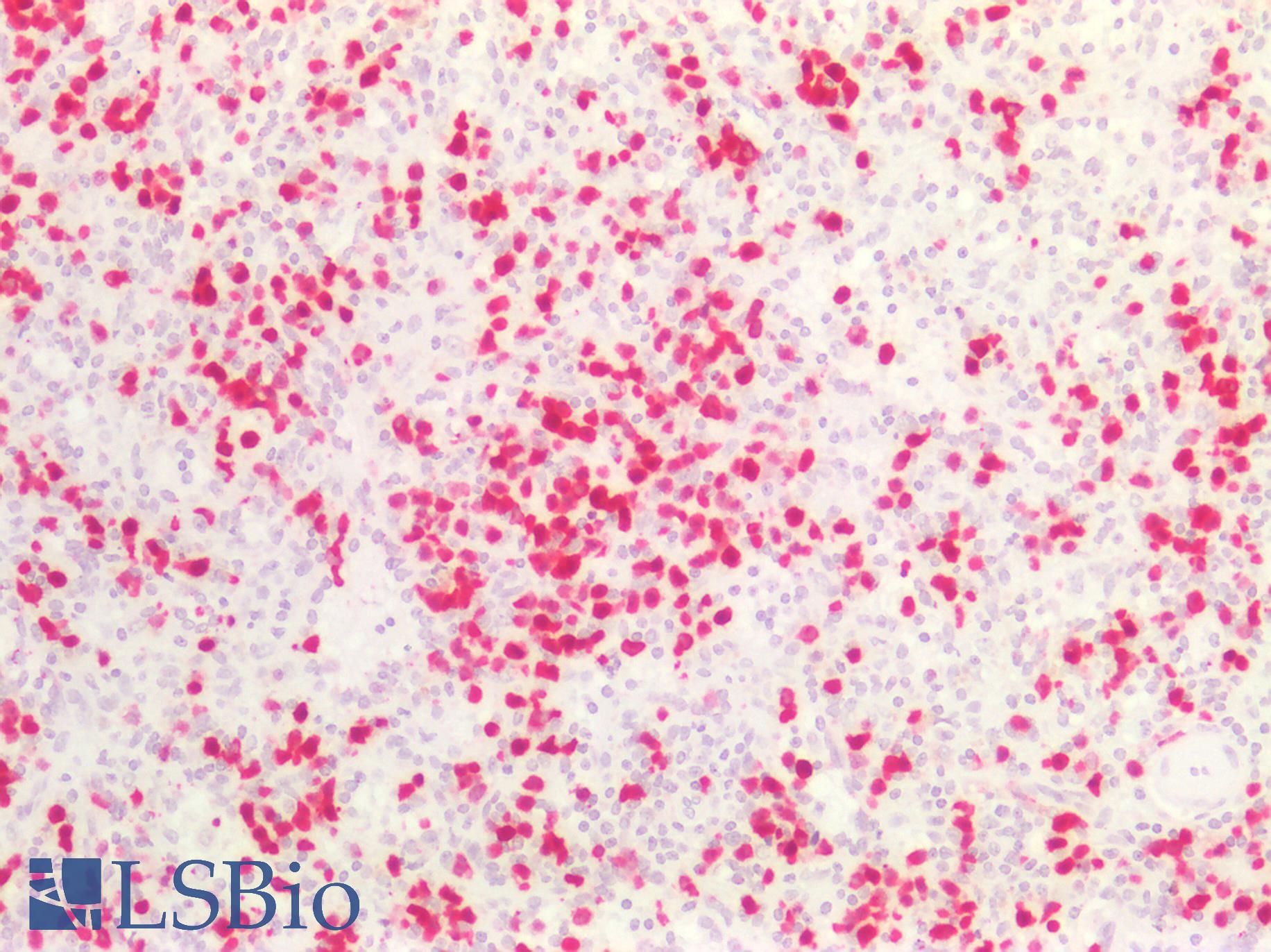 S100A8 / MRP8 Antibody - Human Spleen: Formalin-Fixed, Paraffin-Embedded (FFPE)