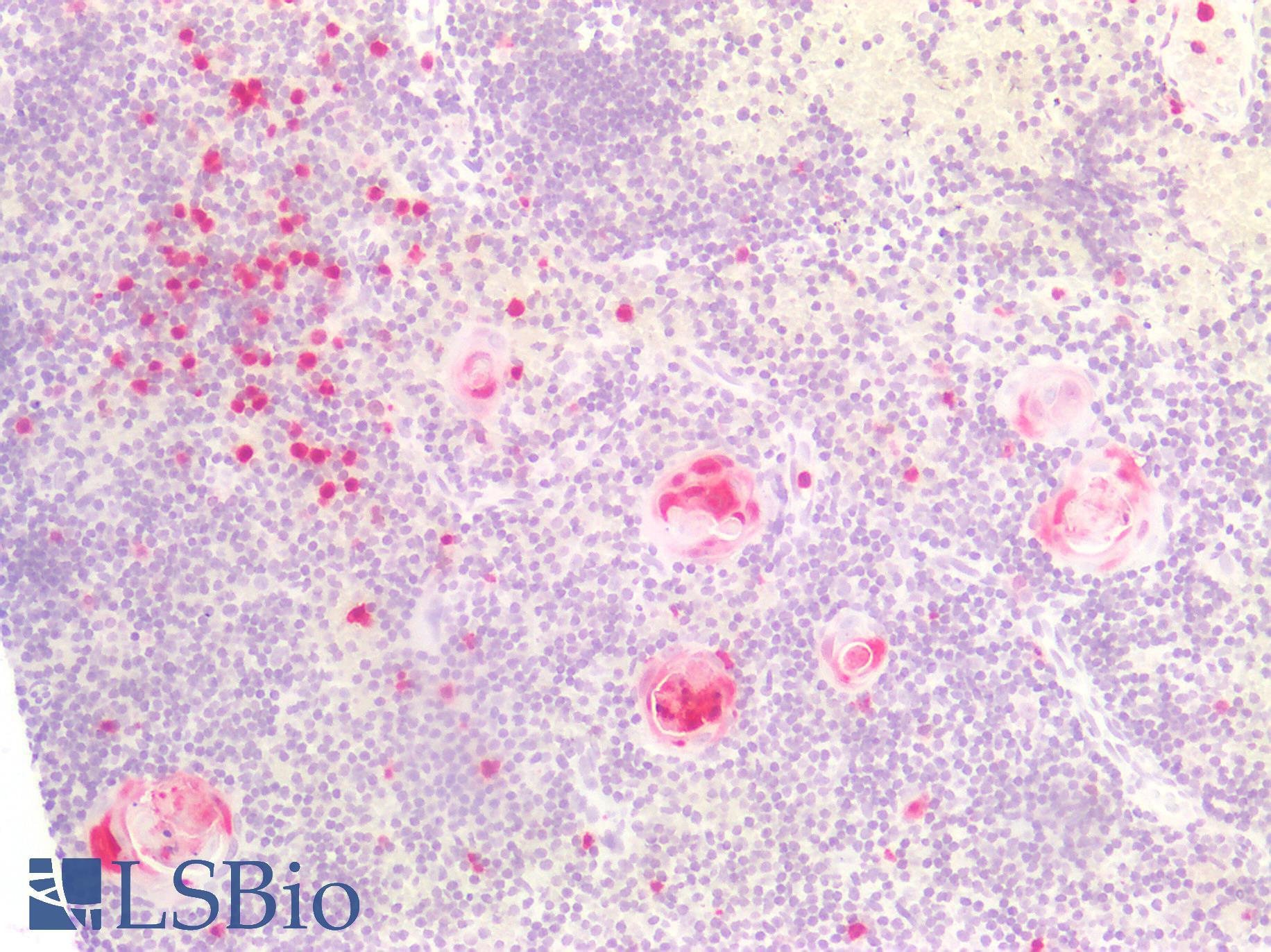 S100A8 / MRP8 Antibody - Human Thymus: Formalin-Fixed, Paraffin-Embedded (FFPE)