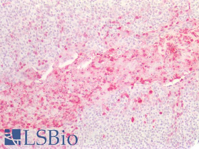 S100A8 / MRP8 Antibody - Human Tonsil: Formalin-Fixed, Paraffin-Embedded (FFPE)