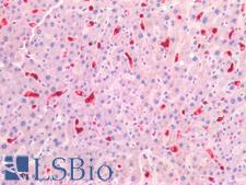 S100A8 / MRP8 Antibody - Human Liver: Formalin-Fixed, Paraffin-Embedded (FFPE)