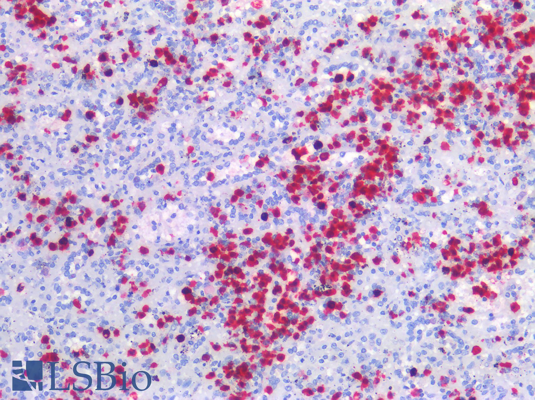 S100A8 / MRP8 Antibody - Human Spleen: Formalin-Fixed, Paraffin-Embedded (FFPE)