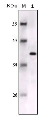 S100B / S100 Beta Antibody - Western blot using S100B mouse monoclonal antibody against full-length S100B recombinant protein.