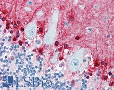 S100B / S100 Beta Antibody - Anti-S100B antibody IHC of human brain, cerebellum. Immunohistochemistry of formalin-fixed, paraffin-embedded tissue after heat-induced antigen retrieval. Antibody dilution 1:200.