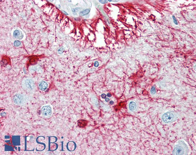 S100B / S100 Beta Antibody - Anti-S100B antibody IHC of human brain, cortex. Immunohistochemistry of formalin-fixed, paraffin-embedded tissue after heat-induced antigen retrieval. Antibody dilution 1:200.