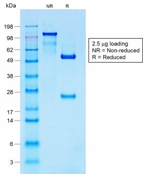 S100B / S100 Beta Antibody - SDS-PAGE Analysis Purified S100B Rabbit Recombinant Monoclonal Antibody (S100B/1706R). Confirmation of Purity and Integrity of Antibody.