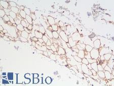 S100B / S100 Beta Antibody - Human Adrenal: Formalin-Fixed, Paraffin-Embedded (FFPE)