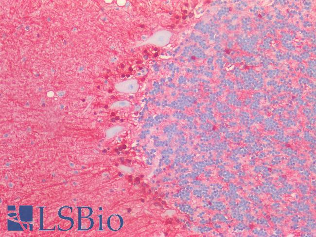 S100B / S100 Beta Antibody - Human Brain, Cerebellum: Formalin-Fixed, Paraffin-Embedded (FFPE)