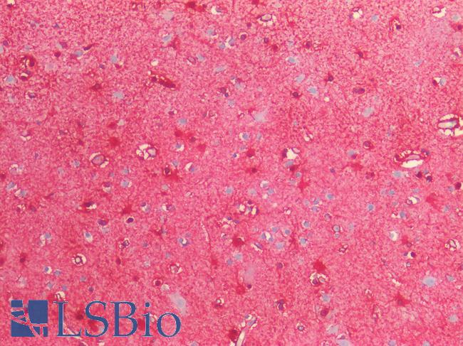 S100B / S100 Beta Antibody - Human Brain, Cortex: Formalin-Fixed, Paraffin-Embedded (FFPE)