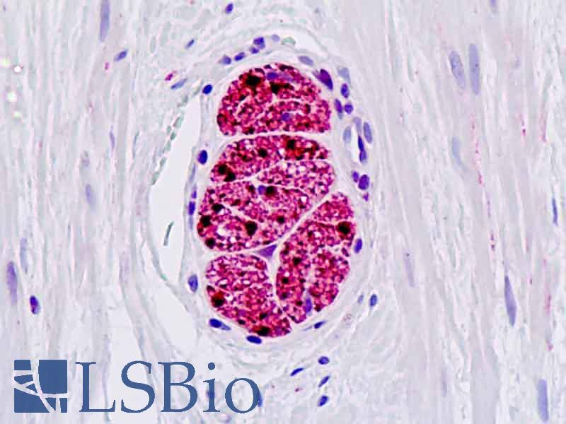 PathPlus™ S100B / S100 Beta Polyclonal Antibody Rabbit Flo,IHC,WB | LSBio