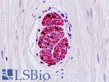 S100B / S100 Beta Antibody - Anti-S100B / S100 antibody IHC staining of human nerve. Immunohistochemistry of formalin-fixed, paraffin-embedded tissue after heat-induced antigen retrieval.