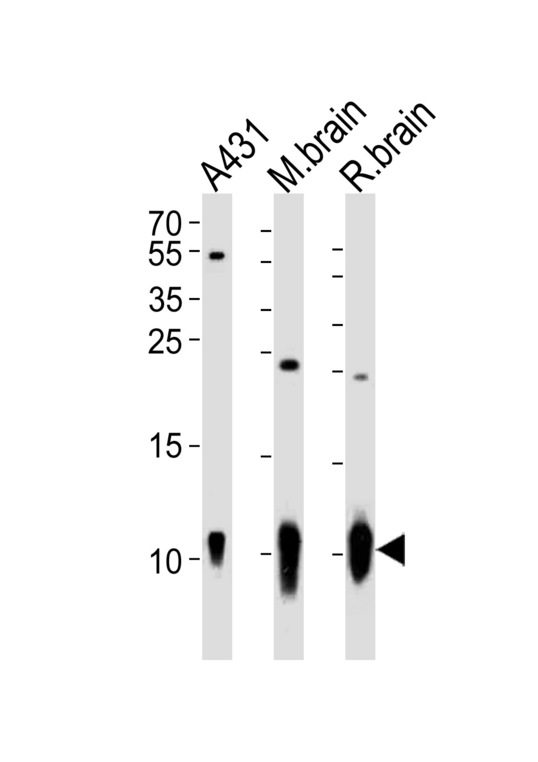 S100B / S100 Beta Antibody - Western blot of lysates from A431 cell line, mouse brain, rat brain tissue (from left to right), using S100B Antibody. Antibody was diluted at 1:1000 at each lane. A goat anti-rabbit IgG H&L (HRP) at 1:10000 dilution was used as the secondary antibody. Lysates at 20ug per lane.