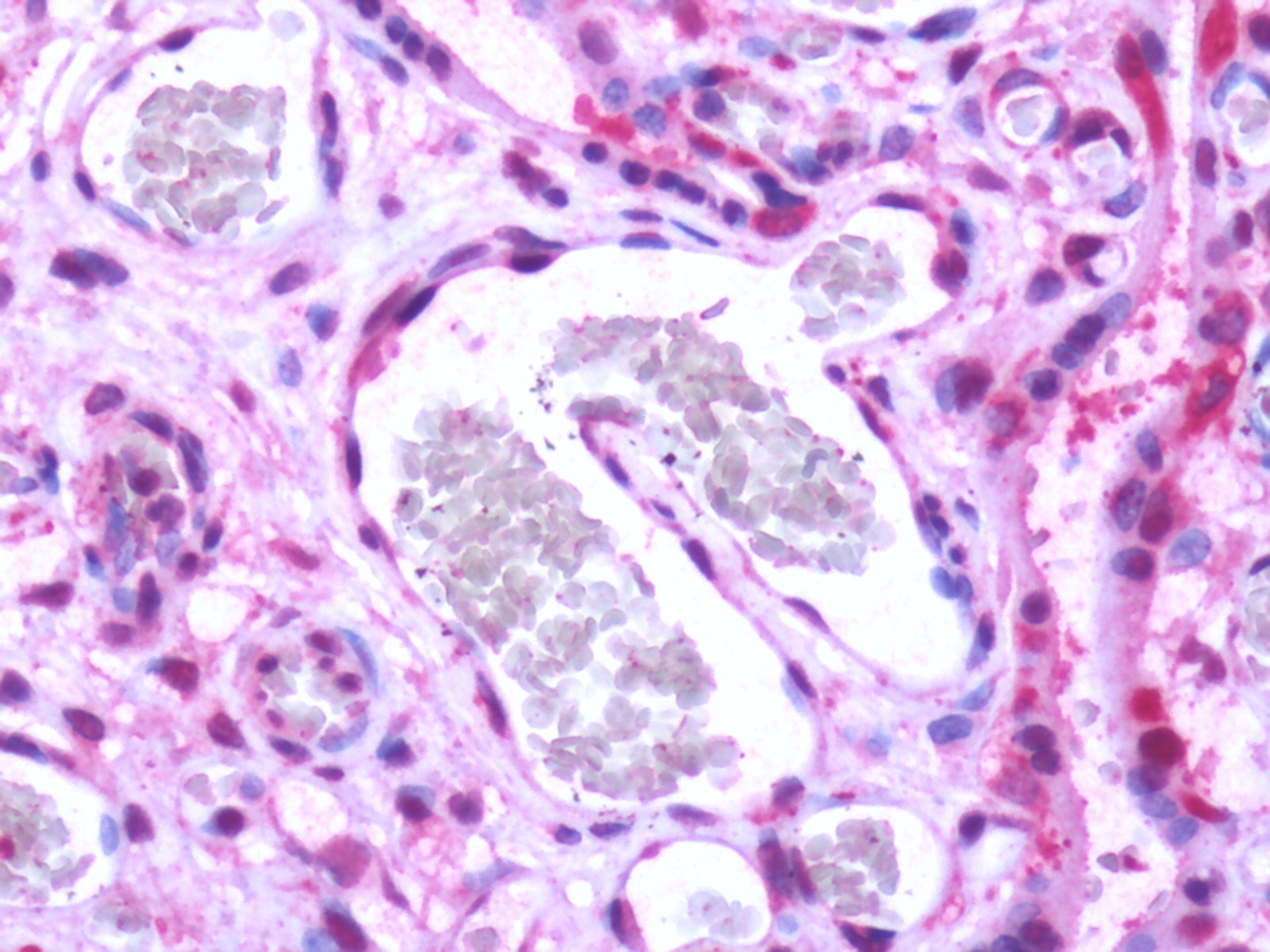 S1PR1 / EDG1 / S1P1 Antibody - Human, Placenta: Formalin-Fixed Paraffin-Embedded (FFPE)