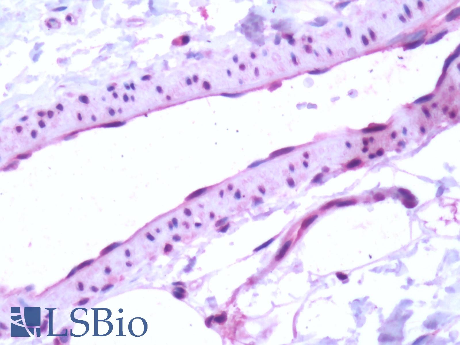 S1PR1 / EDG1 / S1P1 Antibody - Human, Vascular Endothelium: Formalin-Fixed Paraffin-Embedded (FFPE)