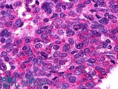 S1PR1 / EDG1 / S1P1 Antibody - Lung, Small Cell Carcinoma