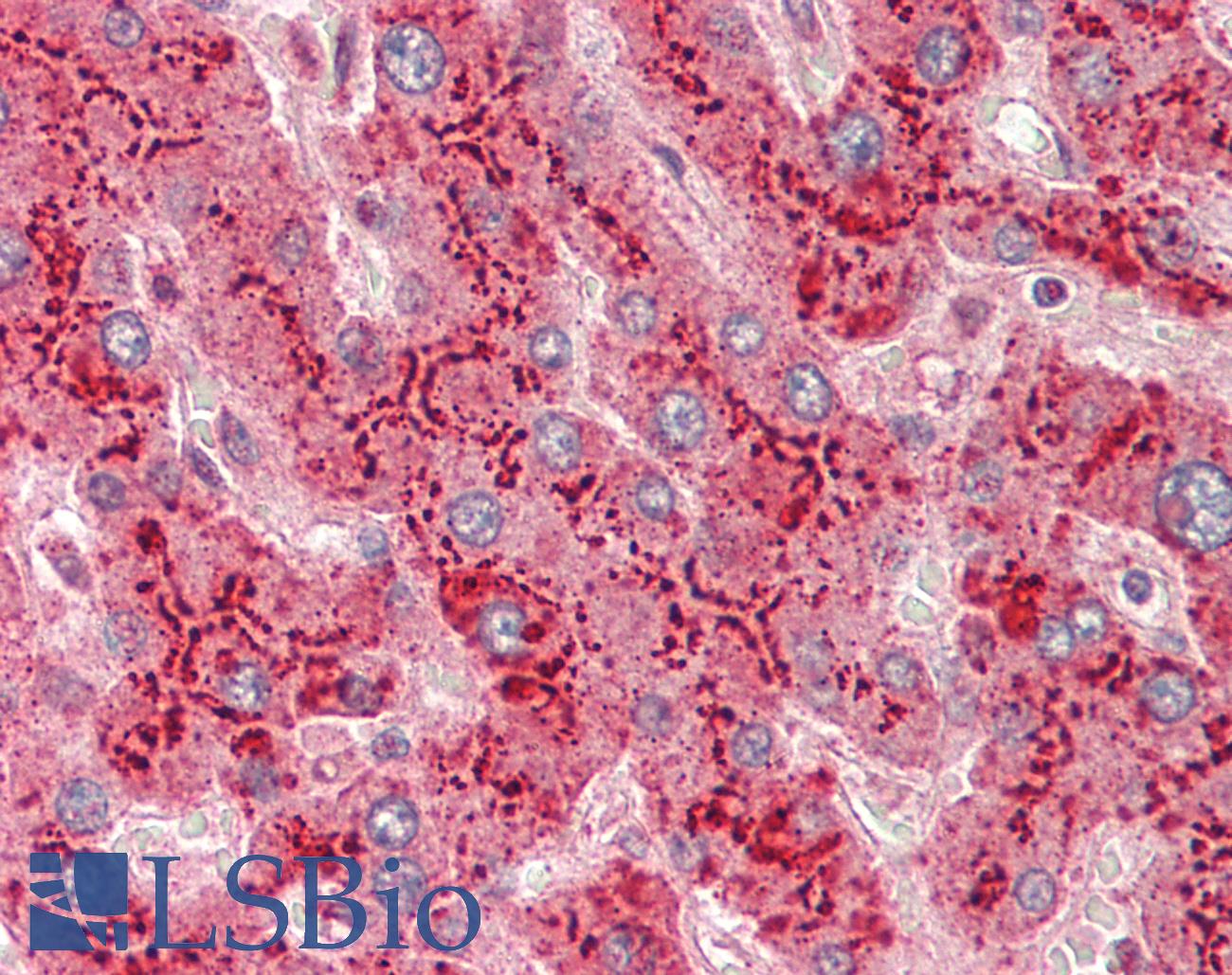 SAA1 / SAA / Serum Amyloid A Antibody - Human Liver: Formalin-Fixed, Paraffin-Embedded (FFPE)
