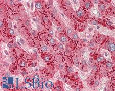 SAA1 / SAA / Serum Amyloid A Antibody - Human Liver: Formalin-Fixed, Paraffin-Embedded (FFPE)